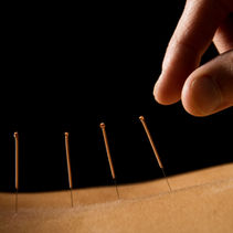 Acupuncture for the Holiday Season: Boost Your Well-Being with Traditional Healing